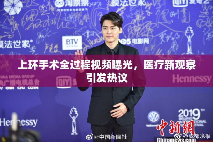 上环手术全过程视频曝光，医疗新观察引发热议