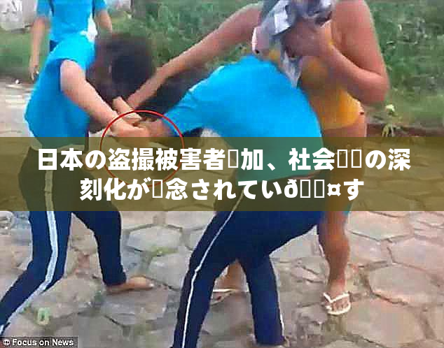 日本の盗撮被害者増加、社会問題の深刻化が懸念されてい🖤す