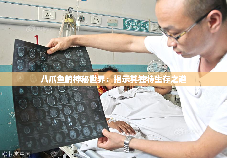 八爪鱼的神秘世界：揭示其独特生存之道