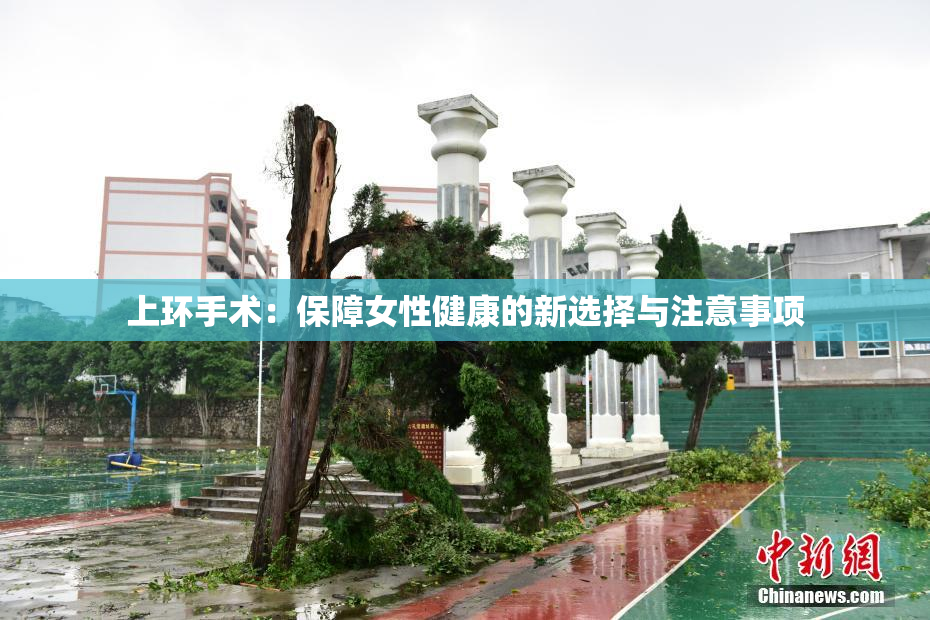 上环手术：保障女性健康的新选择与注意事项