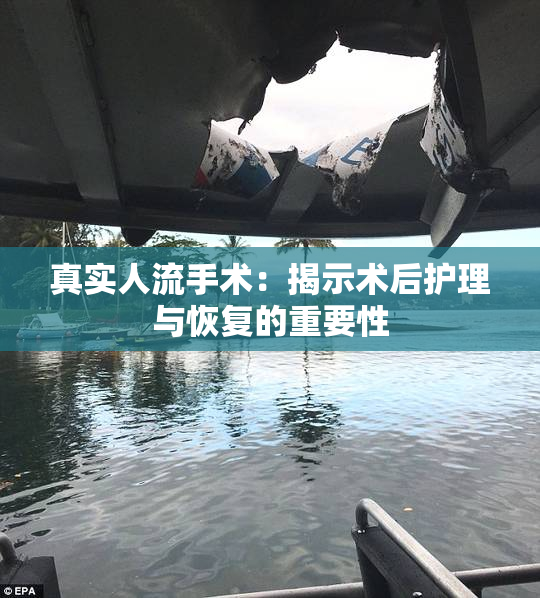 真实人流手术：揭示术后护理与恢复的重要性