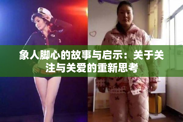 象人脚心的故事与启示：关于关注与关爱的重新思考