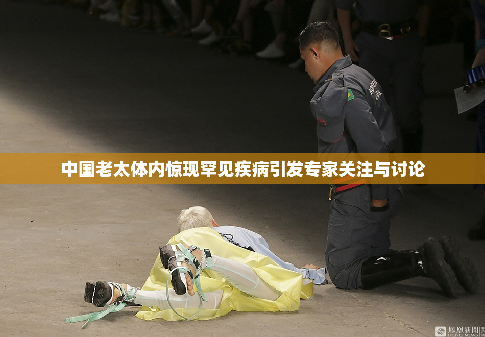 中国老太体内惊现罕见疾病引发专家关注与讨论