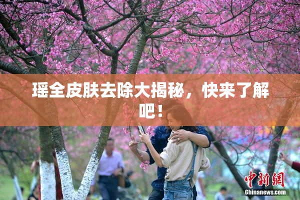 瑶全皮肤去除大揭秘，快来了解吧！