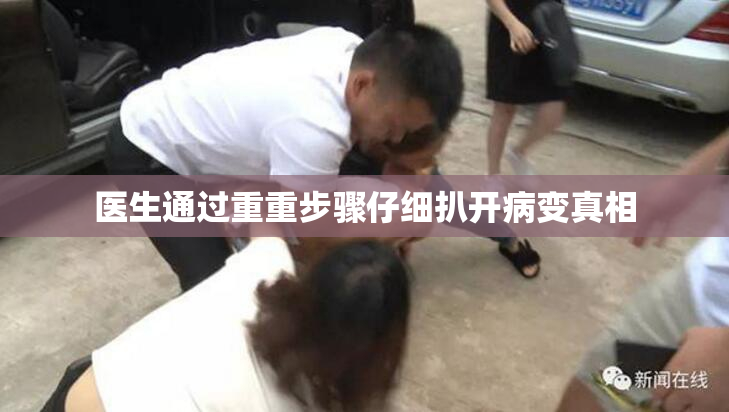 医生通过重重步骤仔细扒开病变真相