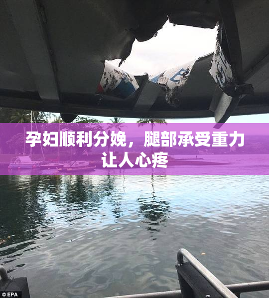 孕妇顺利分娩，腿部承受重力让人心疼