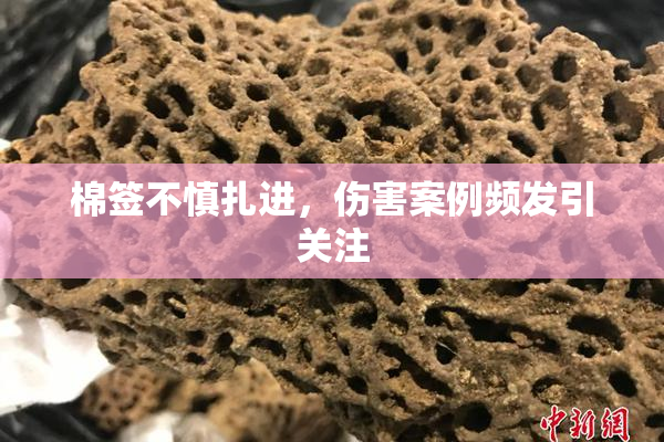 棉签不慎扎进，伤害案例频发引关注