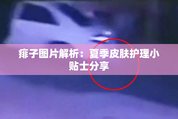 痱子图片解析：夏季皮肤护理小贴士分享