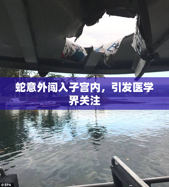 蛇意外闯入子宫内，引发医学界关注