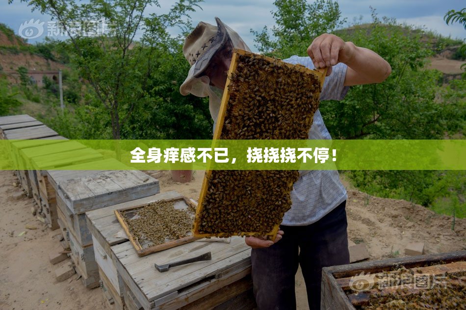 全身痒感不已，挠挠挠不停！