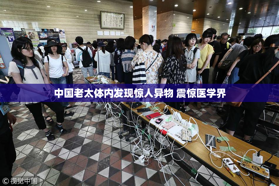 中国老太体内发现惊人异物 震惊医学界